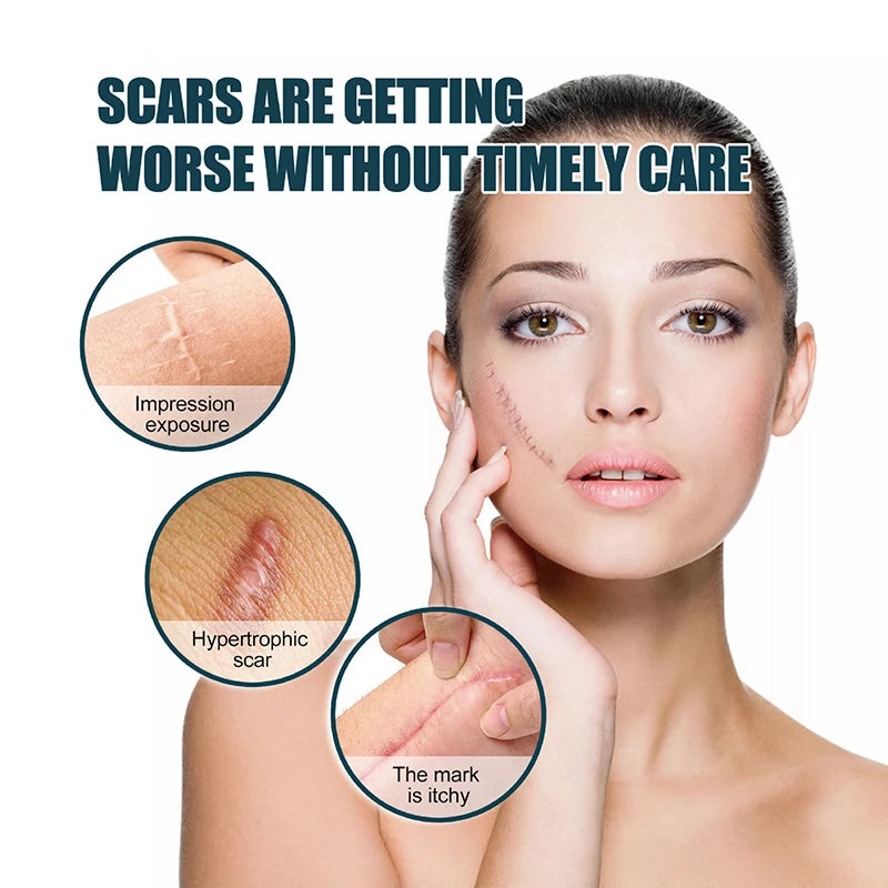 HORSE Silicone Gel Skin Patch Silicone Wound Repair Scar Patches Silicone Scar Patch Skincare Tools 2025